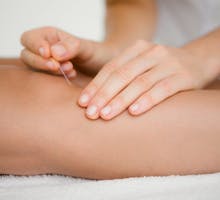 woman using acupuncture to calm her restless legs