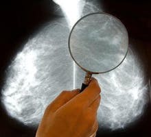 looking at a mammogram x-ray with a magnifying glass