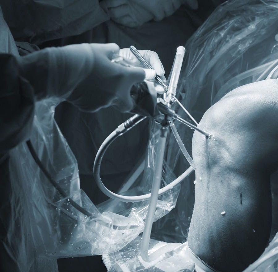 knee surgery