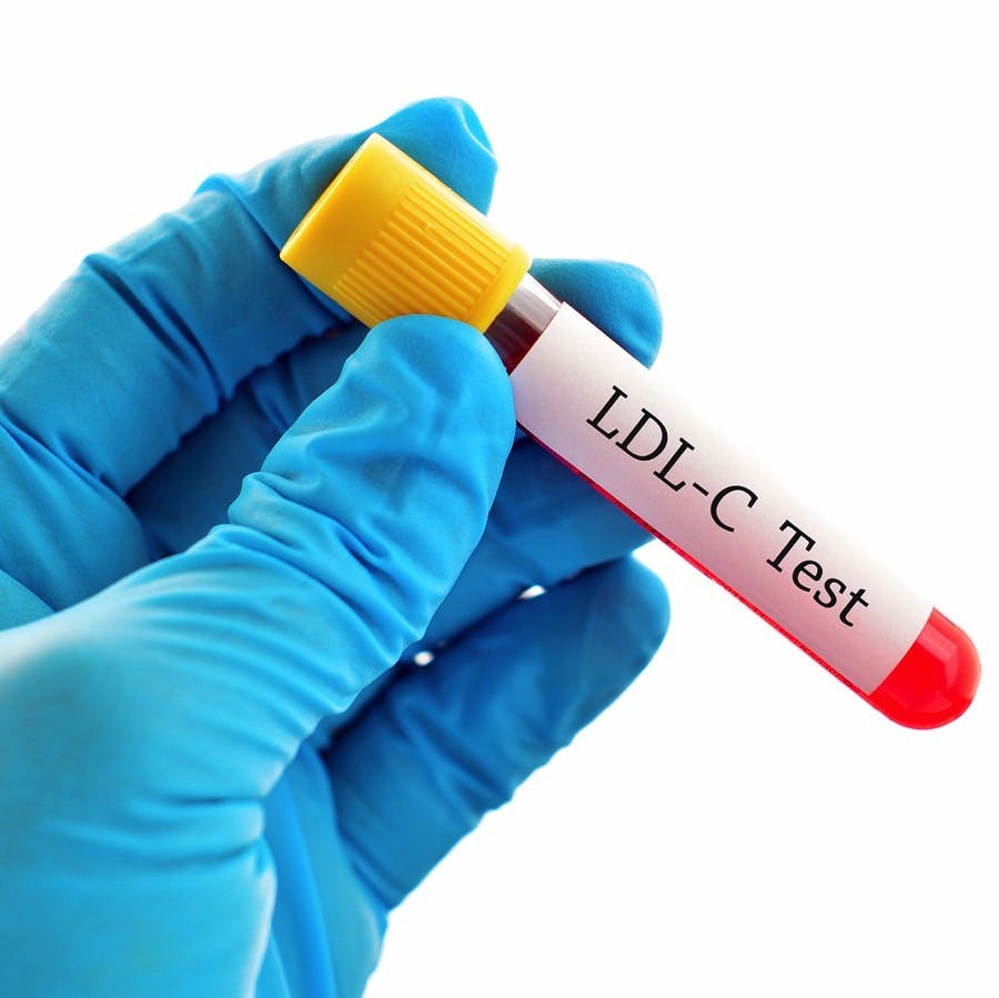 test tube of blood labeled LDL-C Test