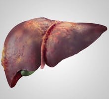 Illustration of damaged human liver