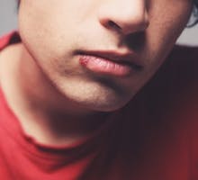 Young man with a cold sore (HSV1) on his lip