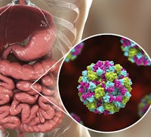 Norovirus in human intestine, 3D illustration