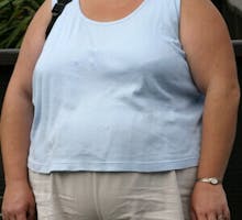 obese woman, overweight
