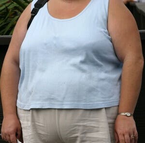 Lyrica And Weight Gain Can It Be Reversed The People S Pharmacy