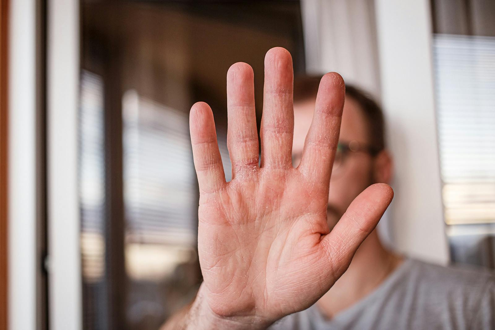 Articles categorized asDry SkinThe People's Pharmacy