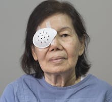 Eye shield covering after cataract surgery