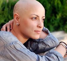 a female cancer patient with no hair